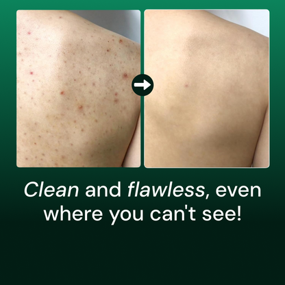 Acne Clear Body Cleanser